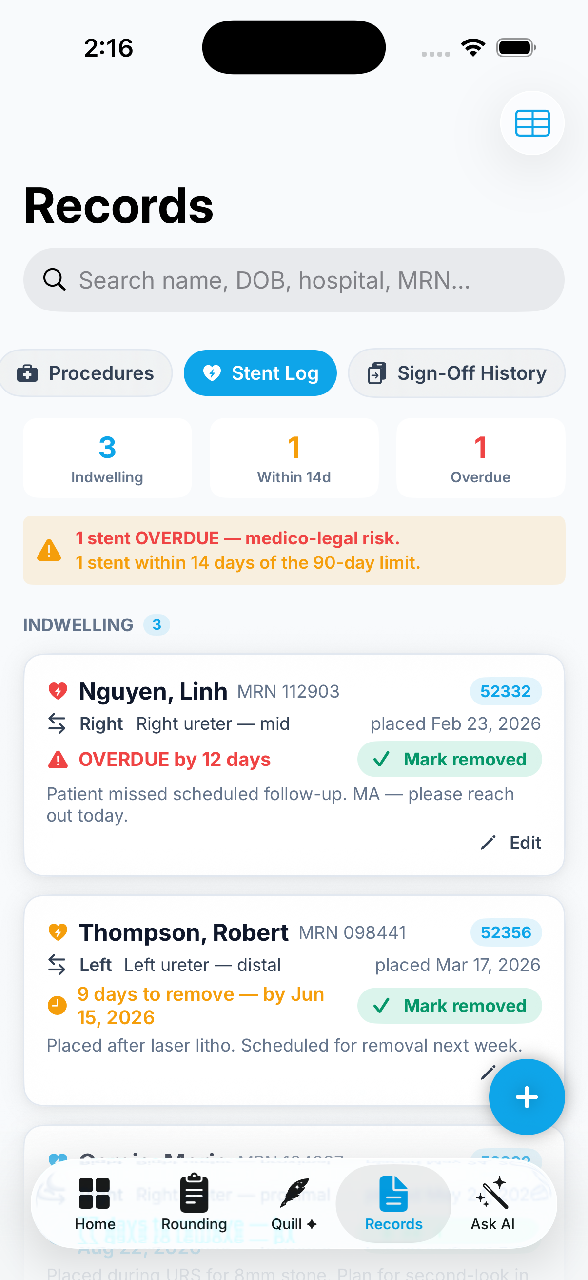 Notafid - Stent Log tracking indwelling ureteral stents with a 90-day removal clock and overdue alerts